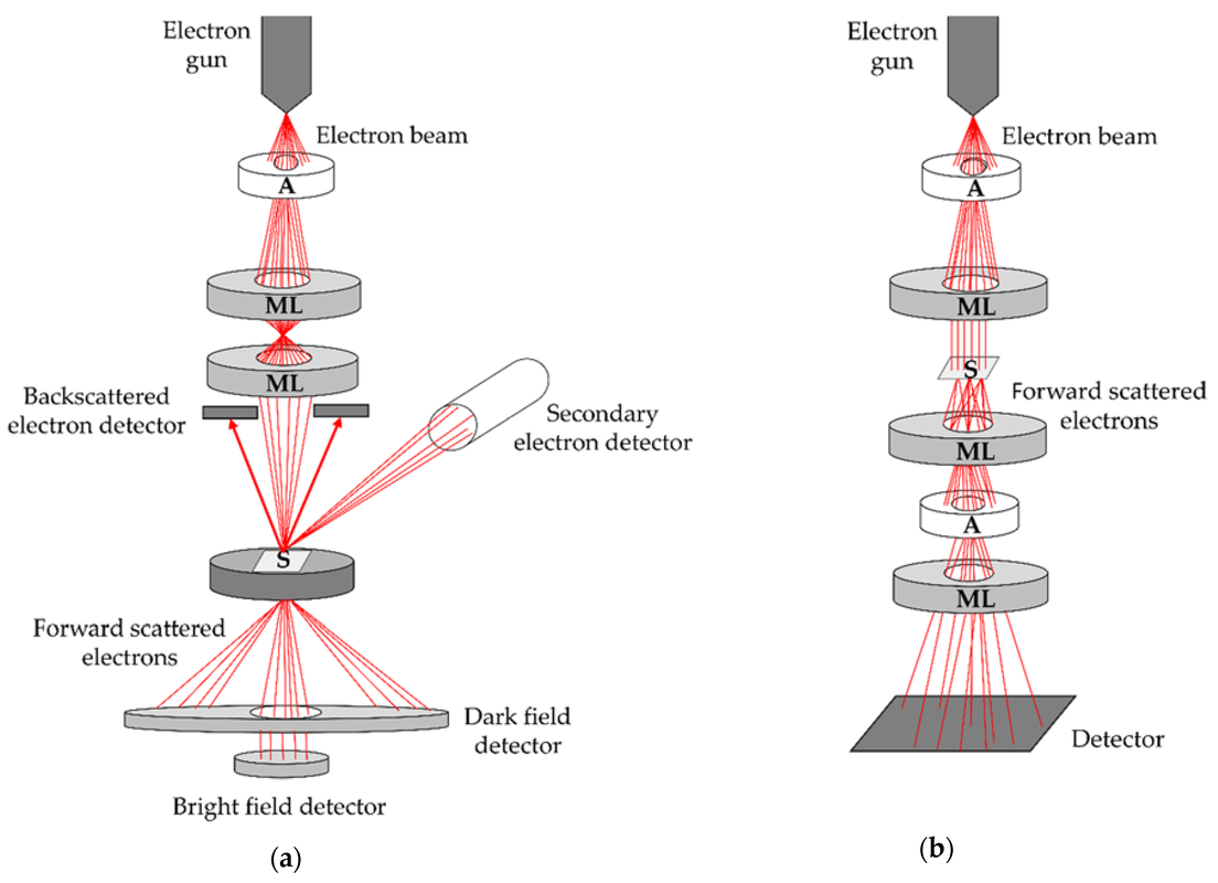Why a Transmission Electron Microscope is the Best Choice to Study Ultrastructural Features